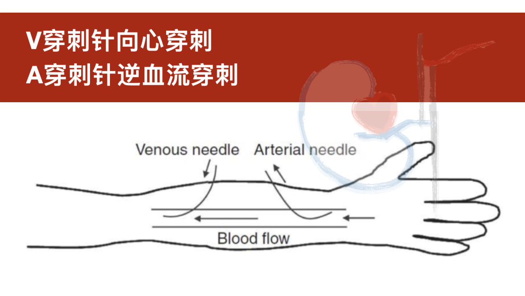 心率_向心_心梗的前兆都有哪些症状