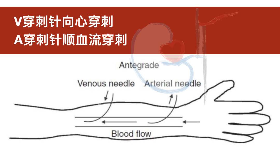 心梗的前兆都有哪些症状_向心_心率
